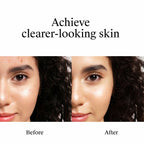 Neutrogena Rapid Clear Stubborn Acne Spot Treatment Gel with Maximum Strength for Acne Prone Skin - 1 oz