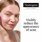 Neutrogena Rapid Clear Stubborn Acne Spot Treatment Gel with Maximum Strength for Acne Prone Skin - 1 oz